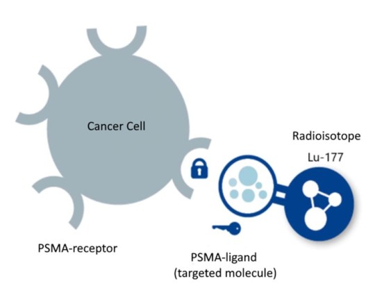 Targeted Therapy Scheme for the Treatment of Prostate Cancer 2