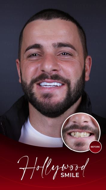 косметична стоматологія Туркеяна