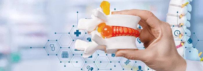 Treatment of a herniated disc with stem cells