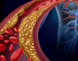 types of atherosclerosis