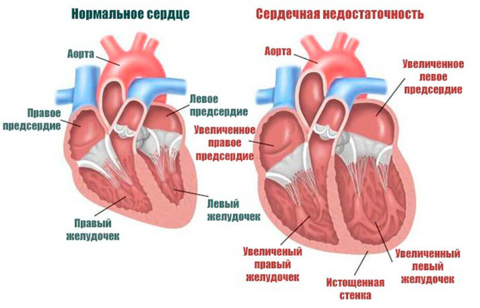 Методы лечения - Кардиологическое отделение №3 - СПб ГБУЗ 