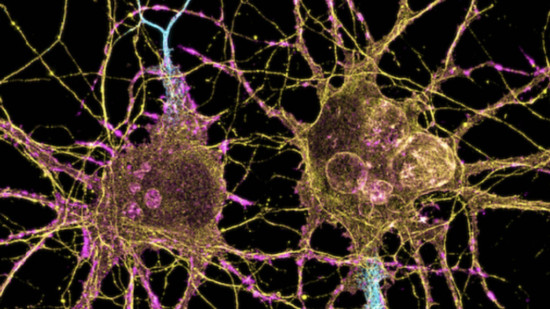 Parkinson's disease_1