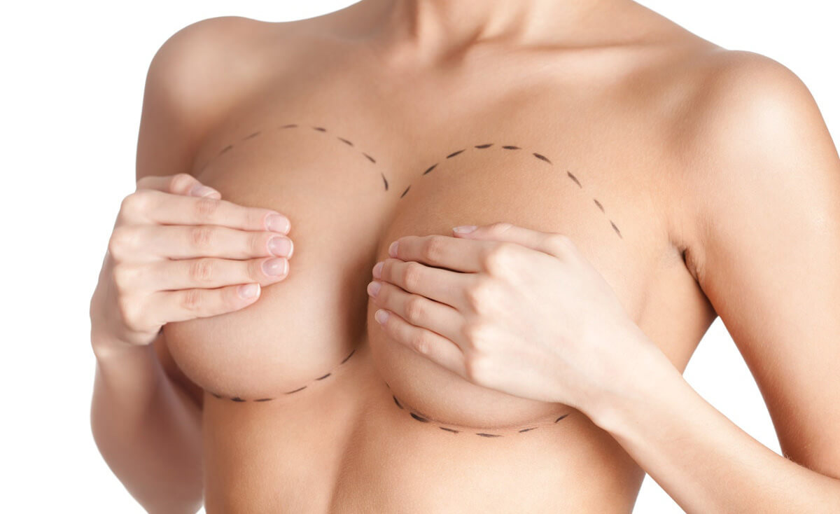 Можно ли отличить натуральную грудь от увеличенной имплантами? | Клиника МедИст | Дзен