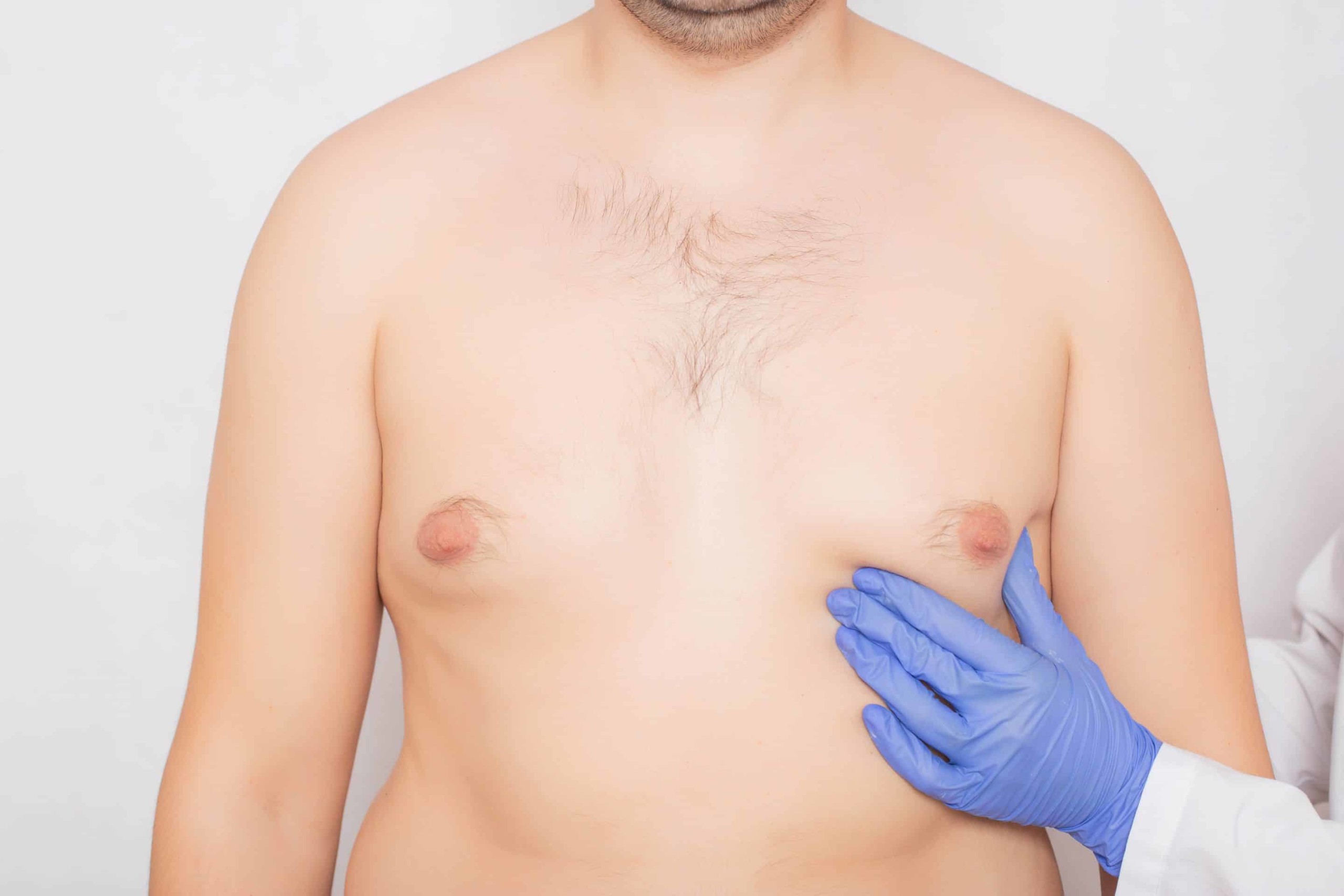 как уменьшить объем груди у мужчин фото 57