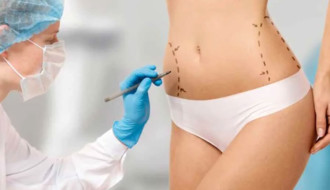 Liposuction: what do you need to know