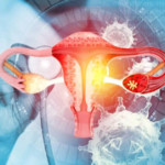 Профилактика рака шейки матки – что нужно делать?