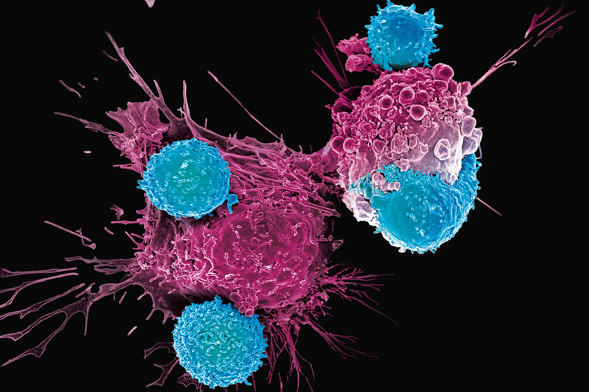 Car-T инновационное лечение рака