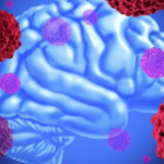 Treatment with cancer-killing viruses works well in trials on brain tumors