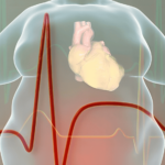 New MRI method predicts heart disease risk based on heart fat content