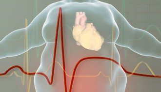 Новий метод МРТ передбачає ризик серцевих захворювань за вмістом жиру в серці