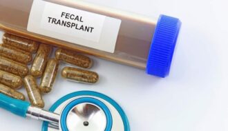 Fecal transplantation offers promise for the treatment of diabetic gastroenteropathy