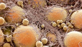 Genetically engineered fat cells inhibit tumor growth and destroy cancer