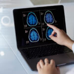 Online Consultation with a Neurosurgeon