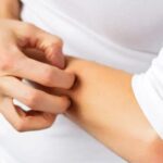 Scratching the skin in case of itching increases inflammation and boosts immune defense