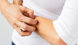 Scratching the skin in case of itching increases inflammation and boosts immune defense