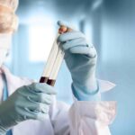 Blood tests for many cancers can prevent progression in half of cases