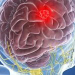 American scientists have discovered a new way to fight brain cancer